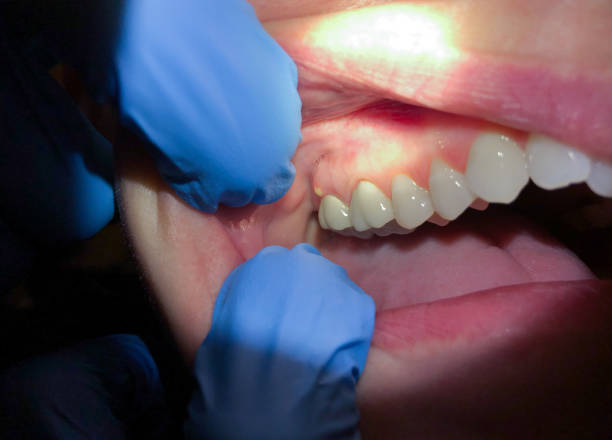 Best Emergency Pediatric Dental Care in Nocona, TX