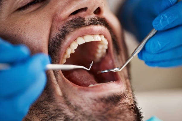 Best Emergency Care for Gum Disease in Nocona, TX